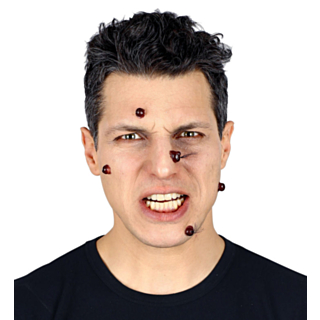 Vårtor