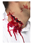 Sår Stygn