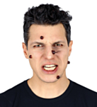 Vårtor