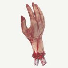 Avhuggen hand