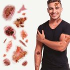 Infekterade Sår Falska Tatueringar
